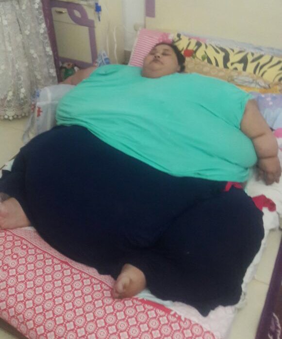 La plus grosse femme du monde sera opérée en Inde