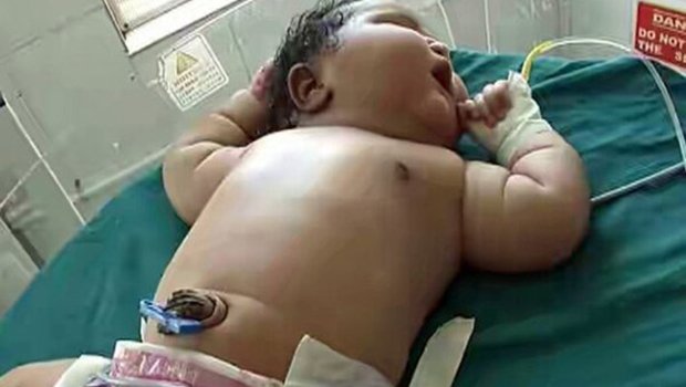 Inde : naissance d’une fillette de 6,8 kilos Inde : naissance d’une fillette de 6,8 kilos