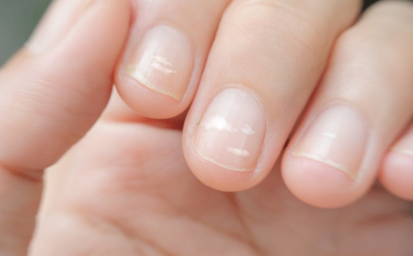 MARQUE BLANCHE SUR LES ONGLES EN ASTROLOGIE : BONNE OU MAUVAISE CHANCE ?