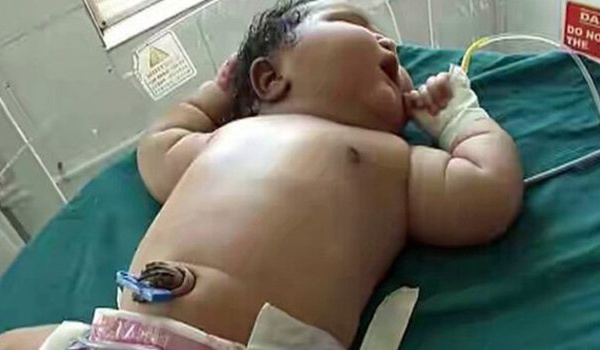 Inde : naissance d’une fillette de 6,8 kilos