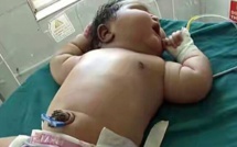 Inde : naissance d’une fillette de 6,8 kilos